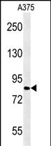 CPEB4 (N-term)