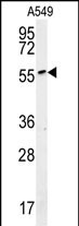 ALG10B