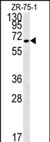 N4BP3 (N-term)