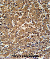 Rabbit Polyclonal Antibody to N4BP3 (N-term)
