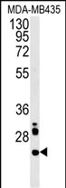 LHPL3  (C-term)