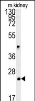 Rabbit Polyclonal Antibody to LHPL3  (C-term)