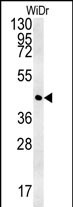 CCYL1  (N-term)