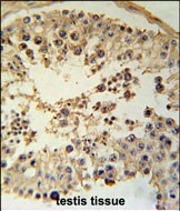 Rabbit Polyclonal Antibody to CCYL1  (N-term)