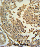 Rabbit Polyclonal Antibody to SYN3