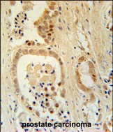 Rabbit Polyclonal Antibody to Z385B  (N-term)