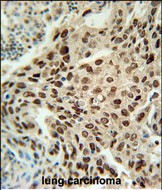 Rabbit Polyclonal Antibody to PRNIP