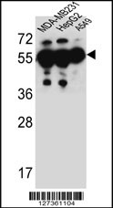 ANKRD57