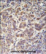 Rabbit Polyclonal Antibody to ANKRD57