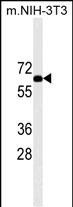 Mouse Monoclonal Antibody to RPS6KB2