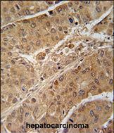 Mouse Monoclonal Antibody to RPS6KB2