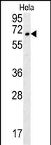 TMEM214 (N-term)