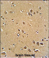 Rabbit Polyclonal Antibody to RFT1