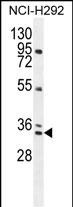 BCA3 (N-term)