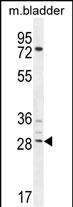 Rabbit Polyclonal Antibody to BCA3 (N-term)