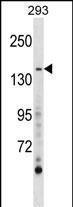 AEBP1