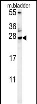 Rabbit Polyclonal Antibody to MUTED