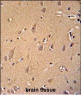 Rabbit Polyclonal Antibody to GCC2