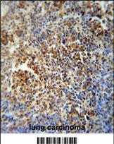 Rabbit Polyclonal Antibody to MAF1