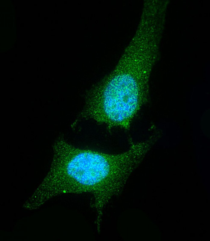 immunofluorescent analysis of 4 % paraformaldehyde fixed 0 1 % triton x ...