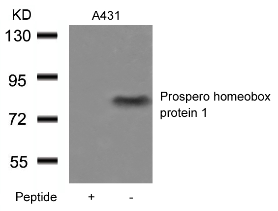 Prospero homeobox protein 1