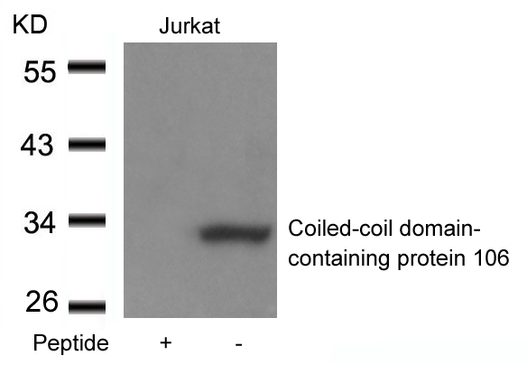 Coiled-coil domain-containing protein 106