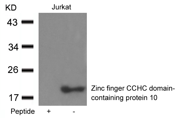 Zinc finger CCHC domain-containing protein 1