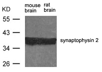 synaptophysin 2