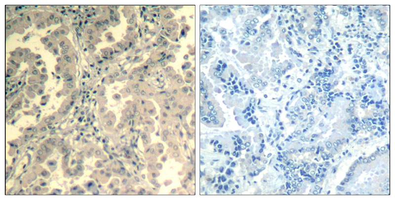 Rabbit Polyclonal Antibody to STAT2(Ab-690)