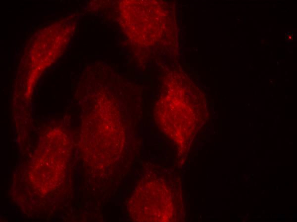 CDK6(Ab-13)