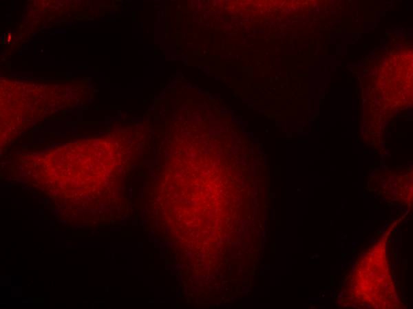 Rabbit Polyclonal Antibody to MDM2(Ab-166)