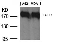 EGFR(Ab-1197) Goat