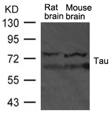 Tau