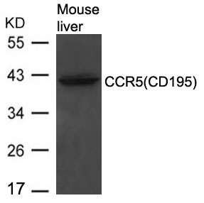 CCR5(CD195)