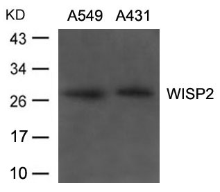 WISP2