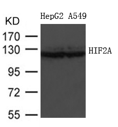 HIF2A
