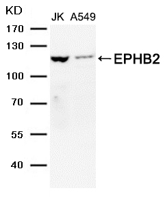 EPHB2