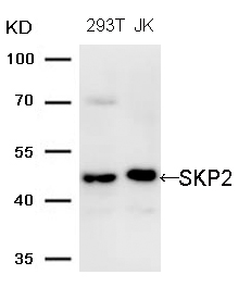 SKP2 (Ab-64)