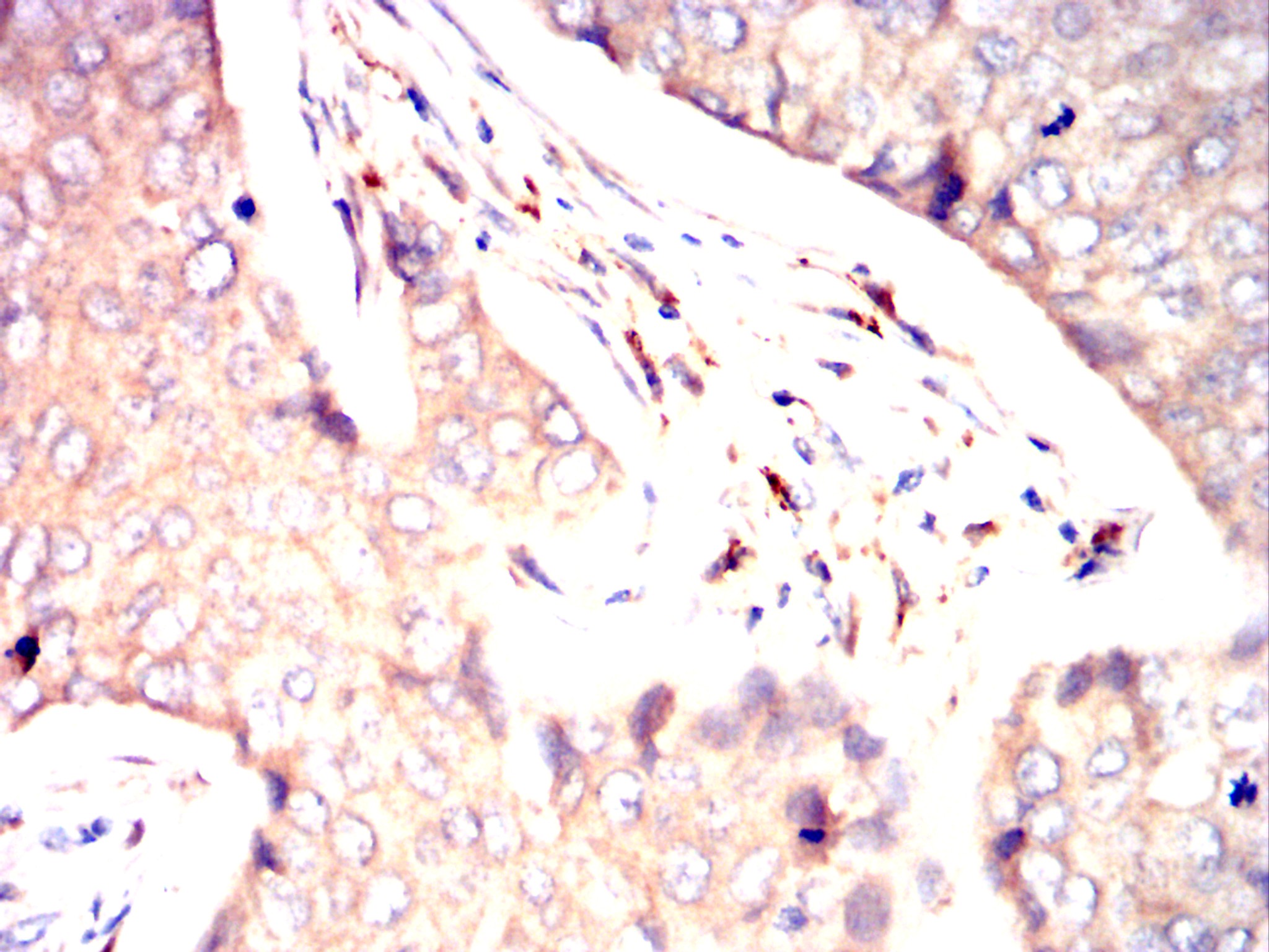 CD116