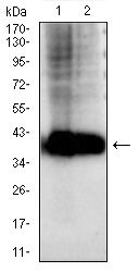 AKR1C1