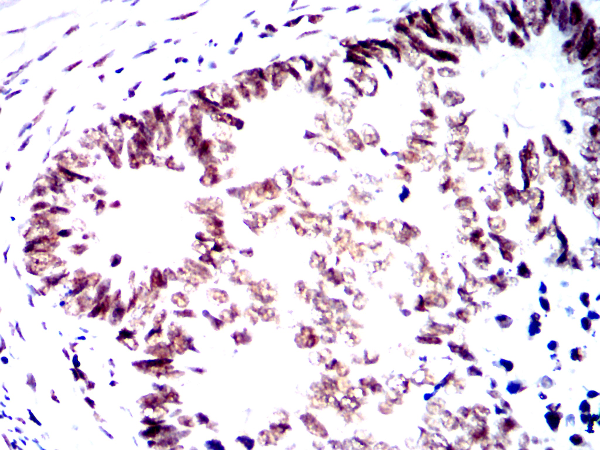 Mouse Monoclonal Antibody to SMARCA2