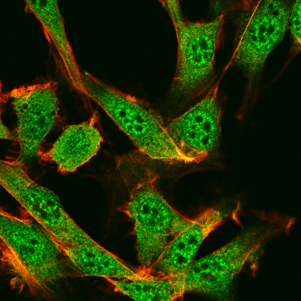 Mouse Monoclonal Antibody to SMARCA2
