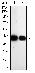 AKR1C1