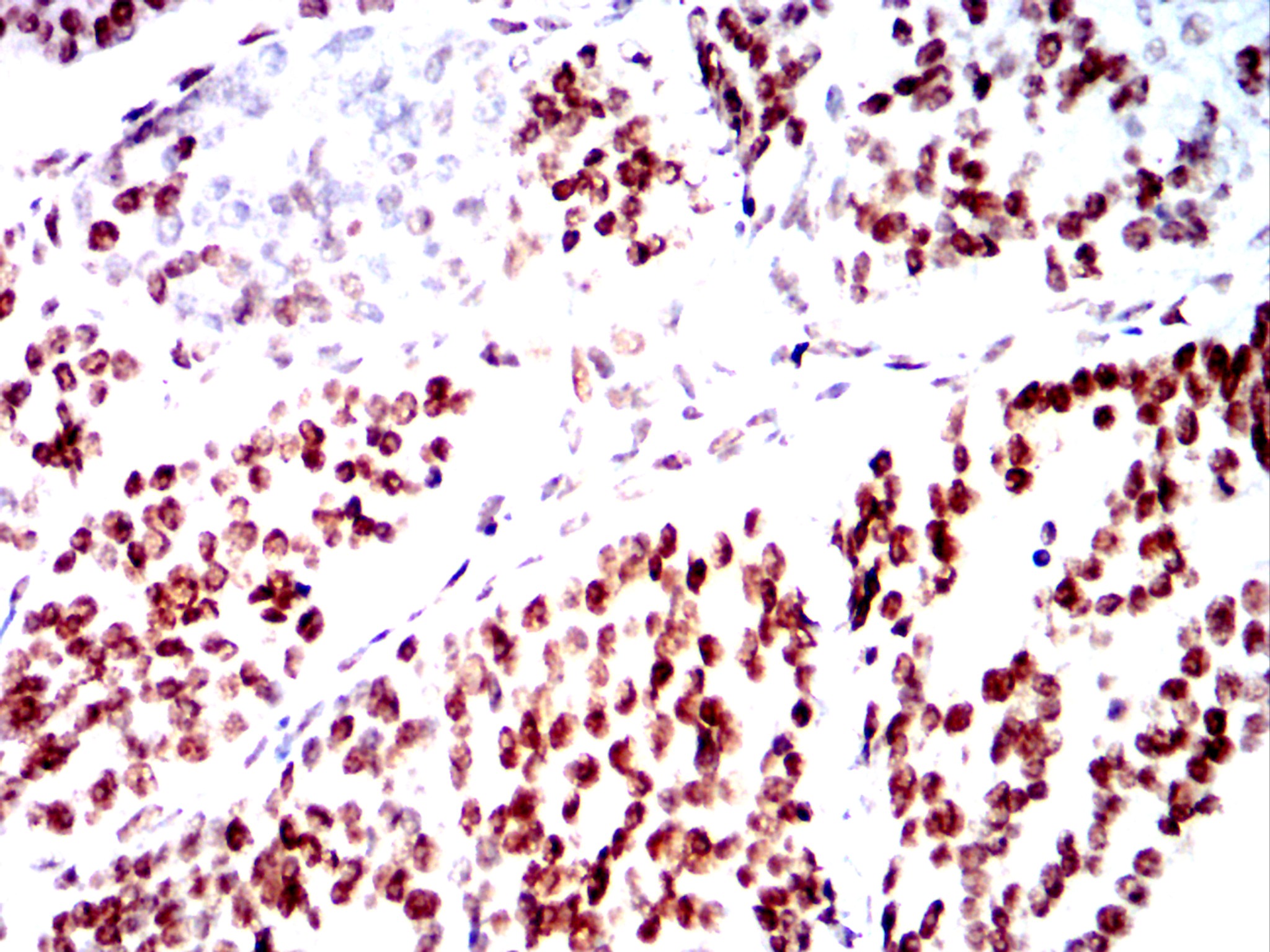 Mouse Monoclonal Antibody to SMARCA2