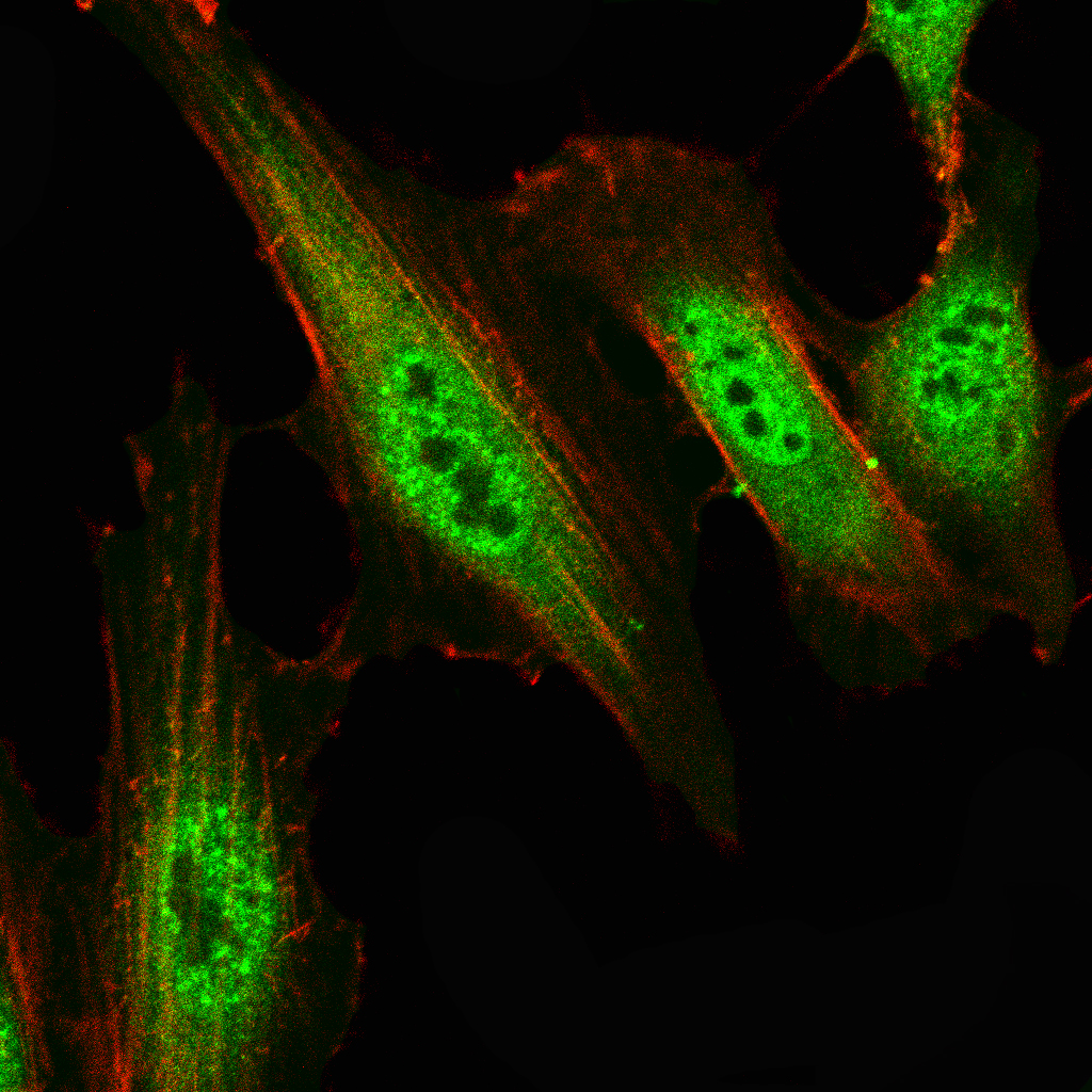 Mouse Monoclonal Antibody to SMARCA2