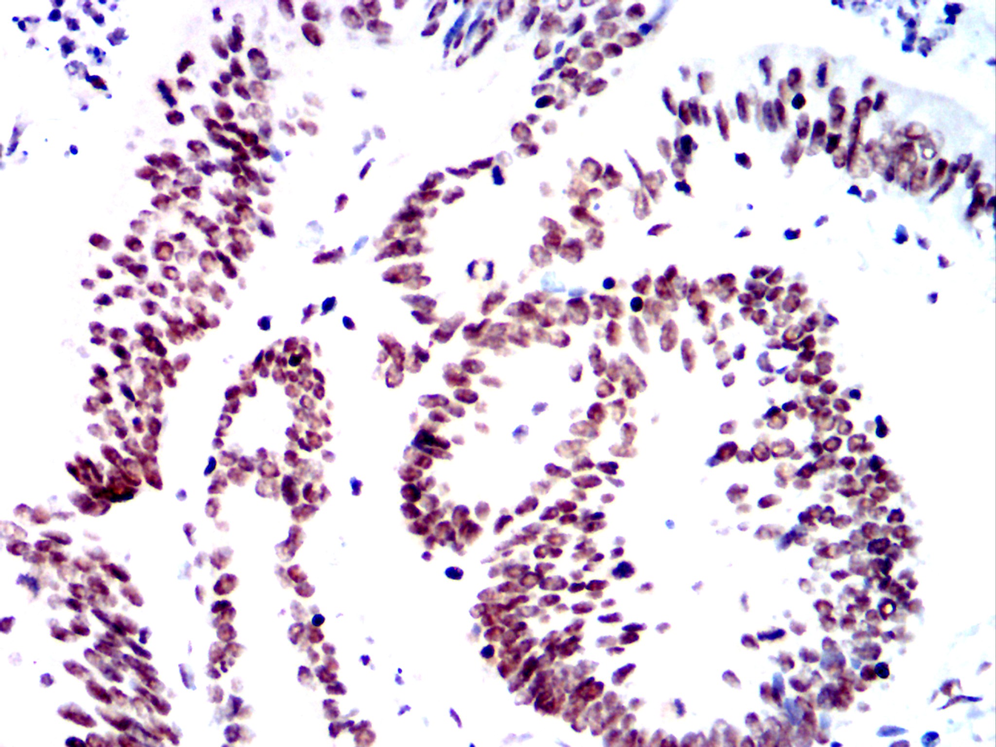 Mouse Monoclonal Antibody to SMARCA2