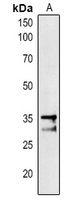 PAP1