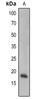 SCE1