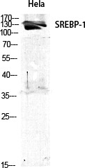 SREBP-1