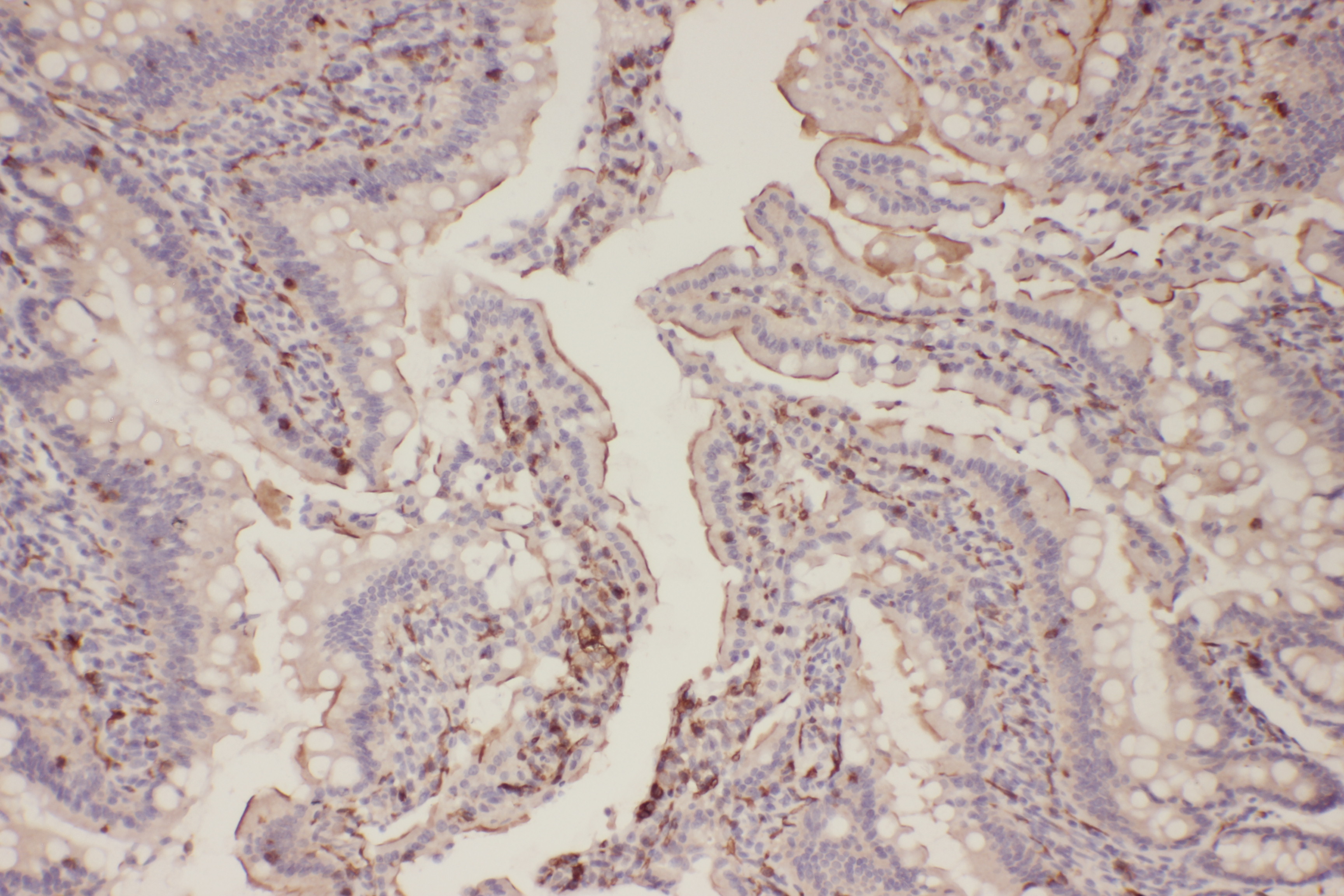 Rabbit Polyclonal Antibody to EGFR(Phospho-Thr678)